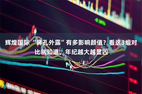 辉煌国际 “鼻孔外露”有多影响颜值？看这3组对比就知道，年纪越大越显凶
